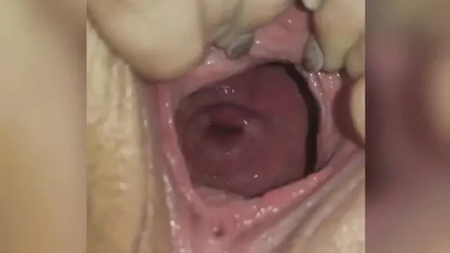 Plump vagina🌮️ and cervical display